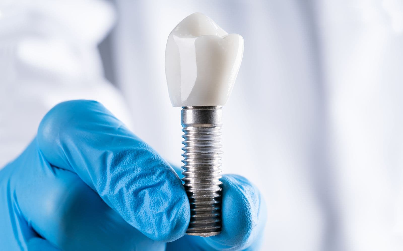 Implant prosthetics — clinical photo